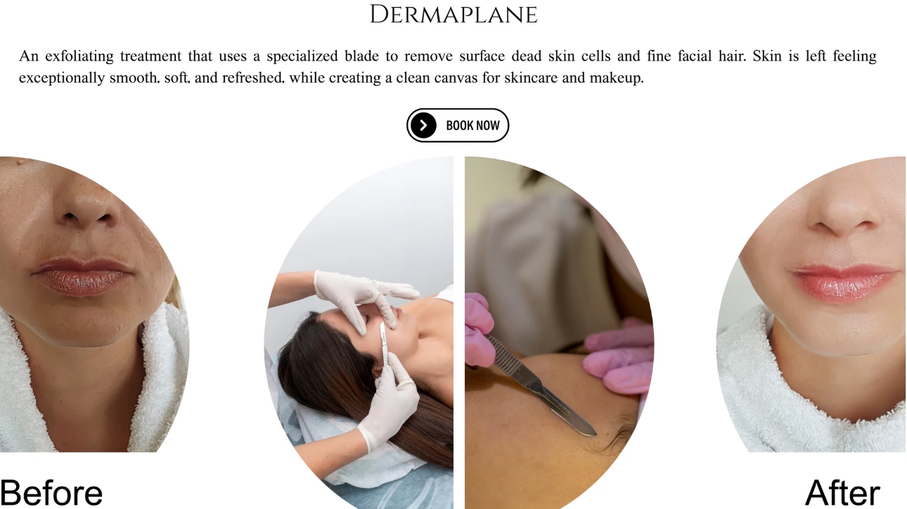 Dermaplaning Facial