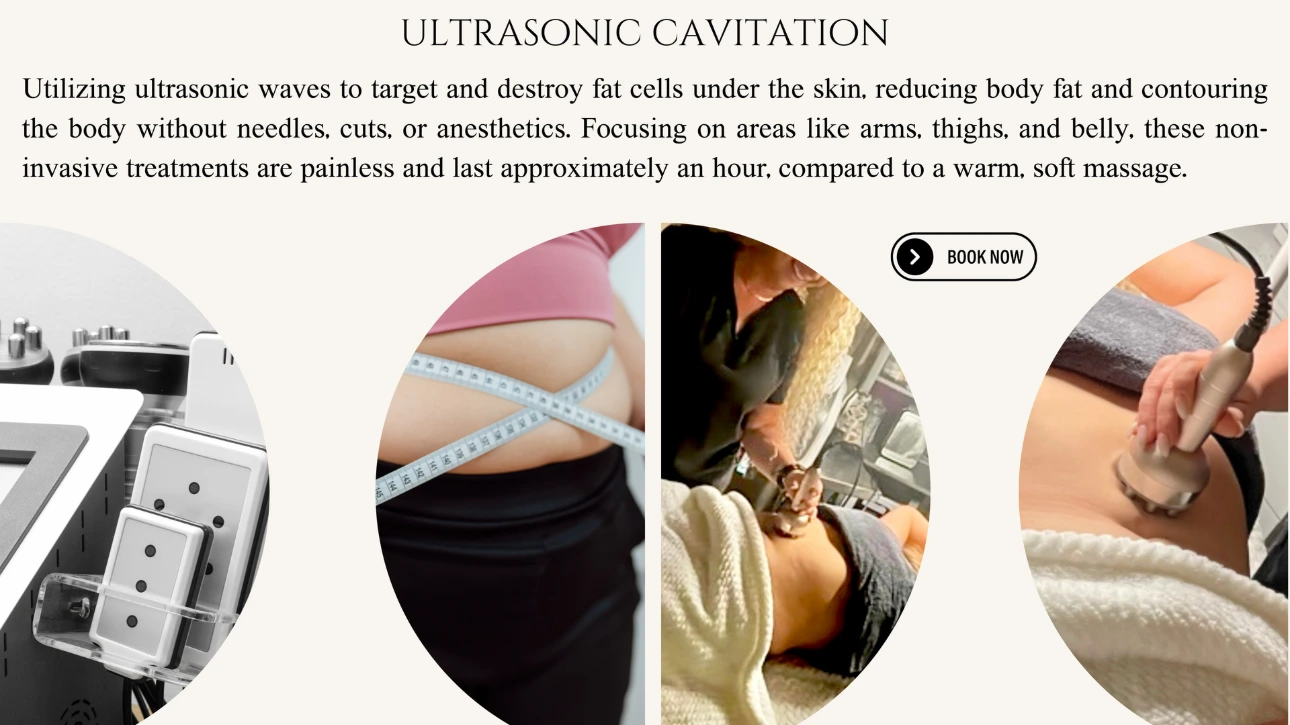 Ultrasonic Fat Cavitation